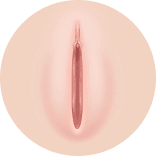 좌우가 대칭인 정상 소음순 모식도