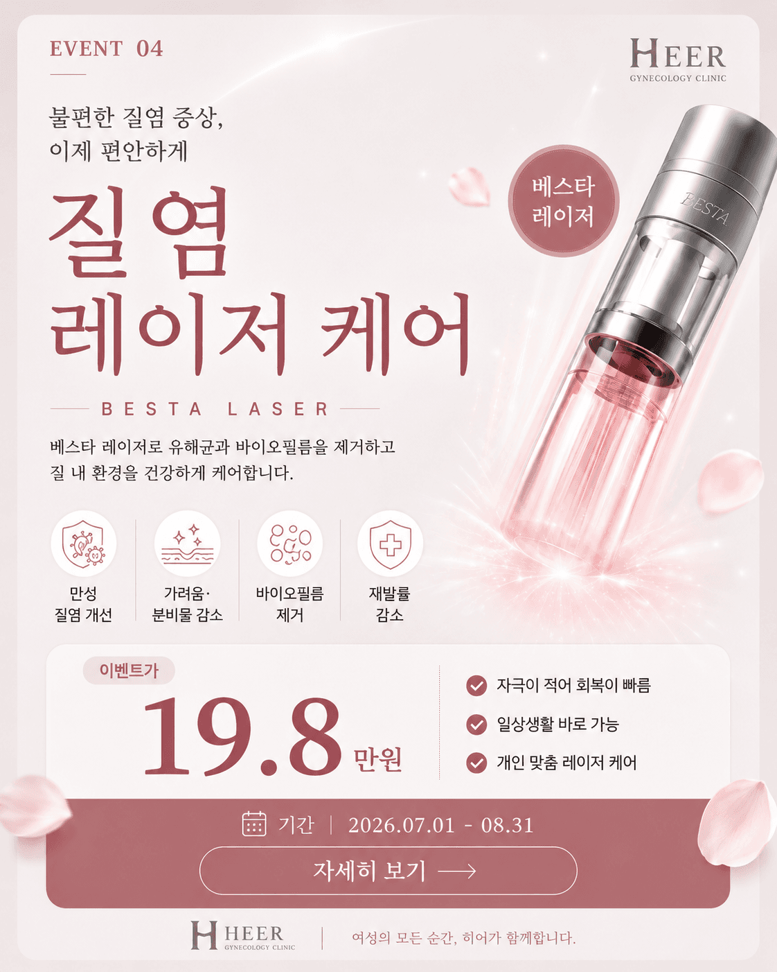 질염 레이저 이벤트