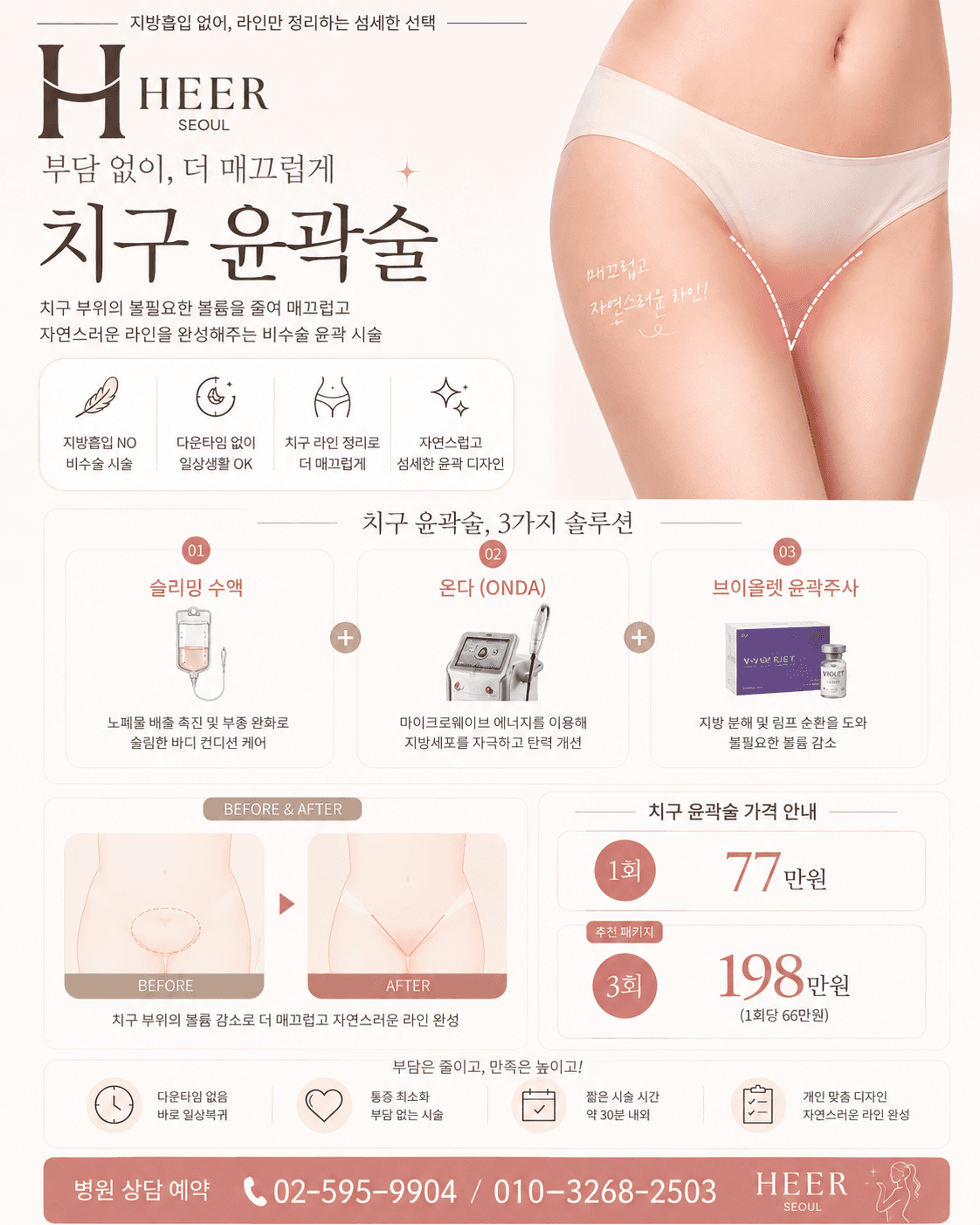 치구 윤곽술 (비수술) 상담